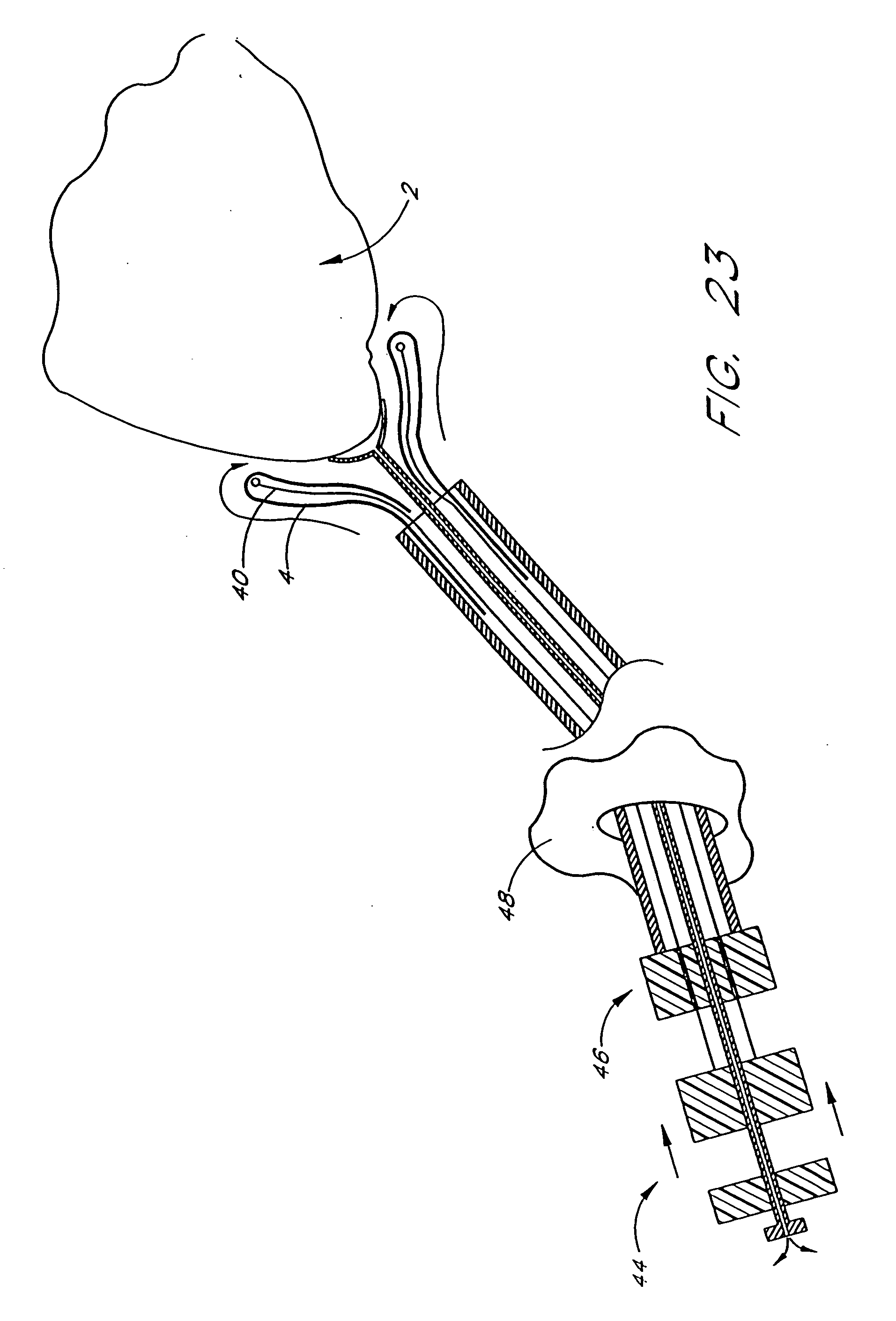 1913x2820 Patent Us20080081944