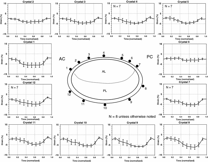 790x615 Strain Vs. Time For Specific Sonocrystals Around The Annulus (N
