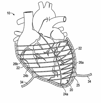 350x359 Cardiac Cycle Related Patent Applications