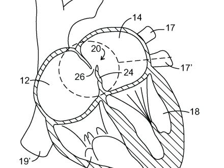 Cardiovascular System Drawing at GetDrawings | Free download