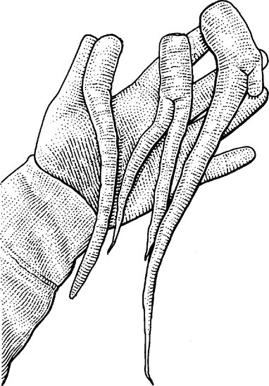 382x548 Supermarkets Make Stars Out Of Weird Apples, Knobbled Carrots