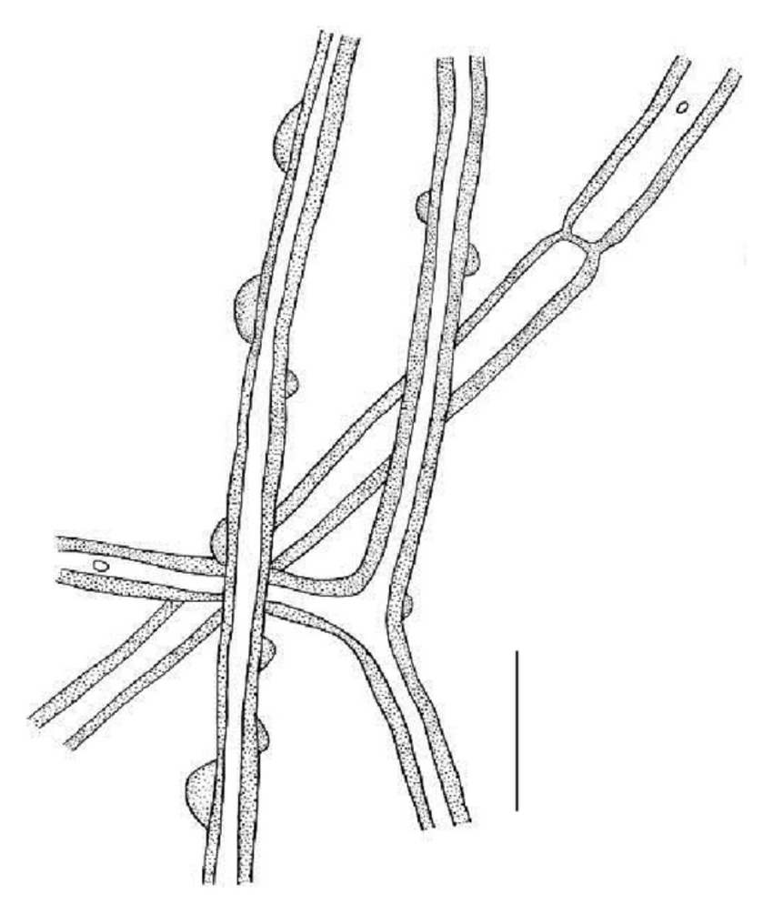 850x1006 Drawings Microstructures Calvatia Nodulata (A) Chains