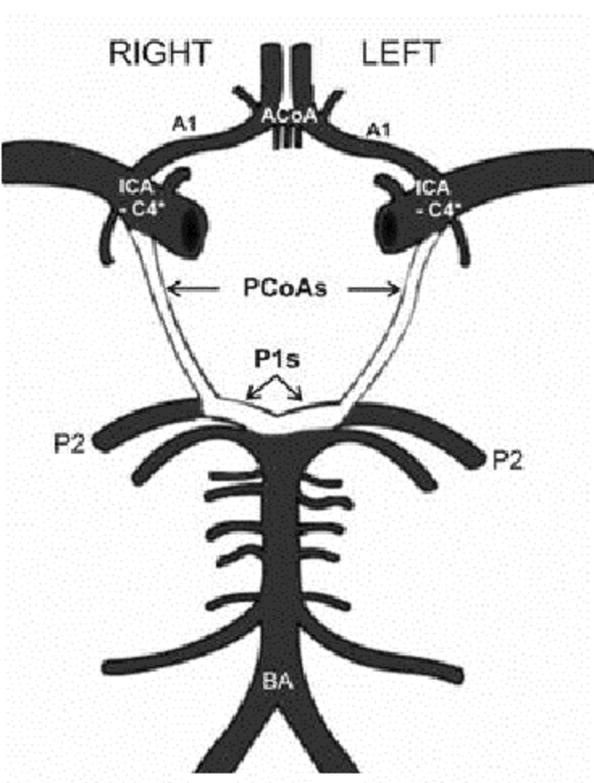 850x1120 Diagram Of Vessels Of The Carotid And Vertebrobasilar Systems