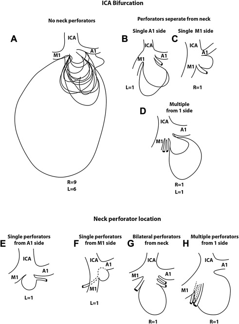 Circle Of Willis Drawing at GetDrawings | Free download