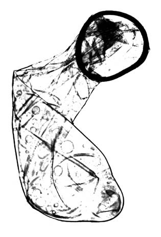 315x461 Men's Rights Redditors Defend A Guy Who Says He Punched His Sperm