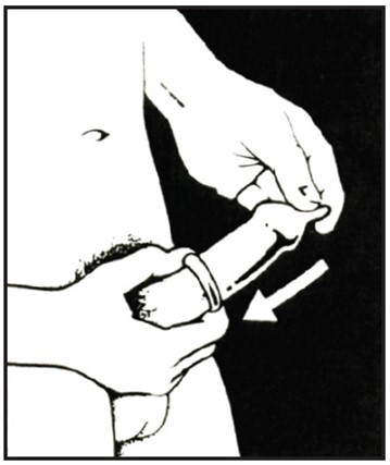 359x427 Using Condomsusing Condoms