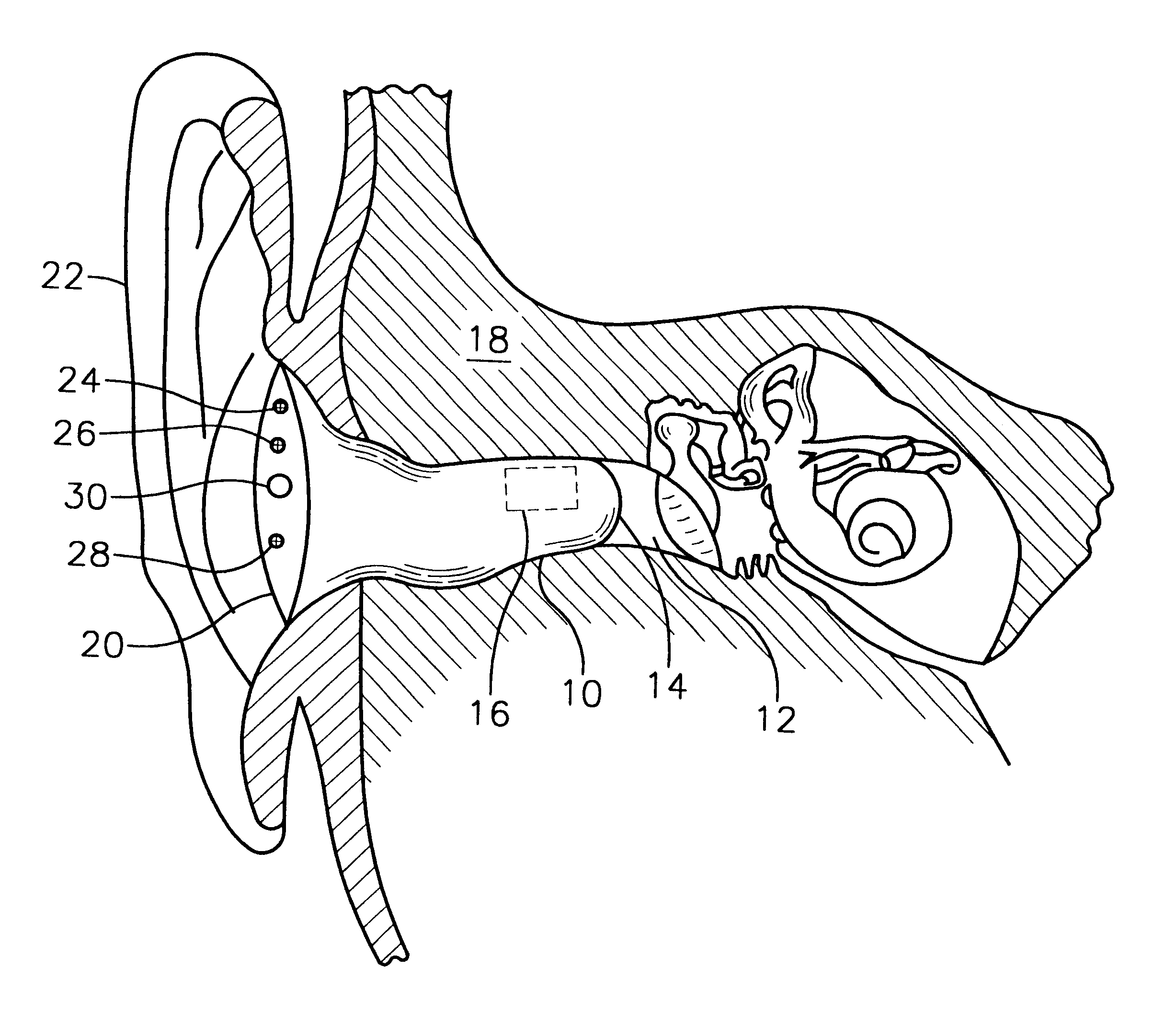 [DIAGRAM] Bone Conduction Headphones Diagram - WIRINGSCHEMA.COM