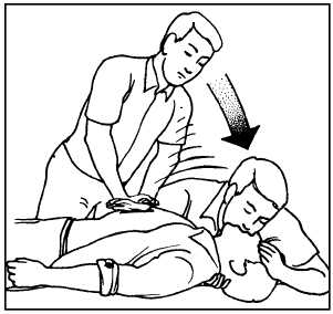 301x284 Figure 1 4.one Rescuer Cpr Technique