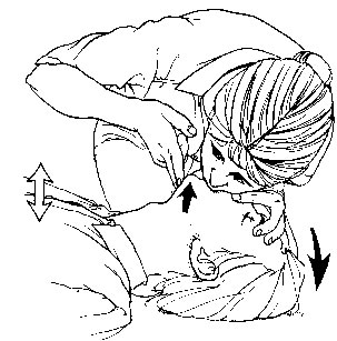 303x307 Rescue Breathing