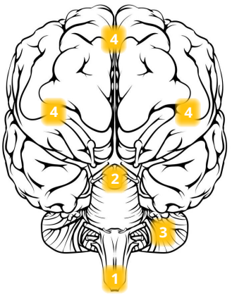 329x426 Eeg (Electroencephalography) The Complete Pocket Guide