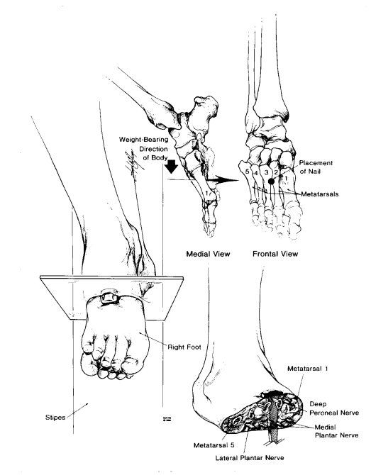 523x670 Death By Crucifixion And Christ Death, Bible And Christianity