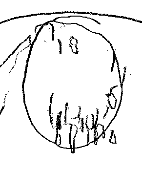 291x348 Clock Of Week September 15, 2017 Concussion Assessment