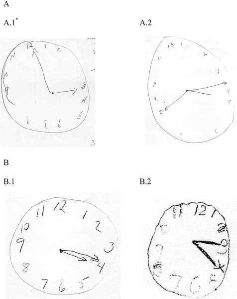 476x600 Does The Clock Drawing Test Have Focal Neuroanatomical Correlates
