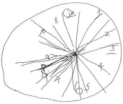 394x335 Alzheimer's Disease Diet And Supplementation
