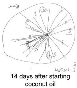 250x283 Best Alzheimer's Clock Ideas On House Afternoon