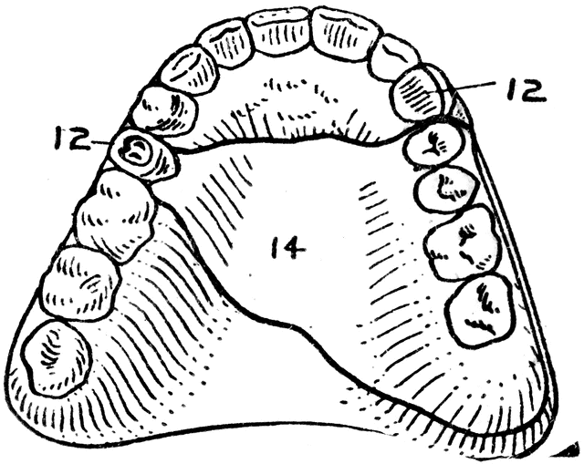 640x509 Dental Anchorage Denture Clipart Etc