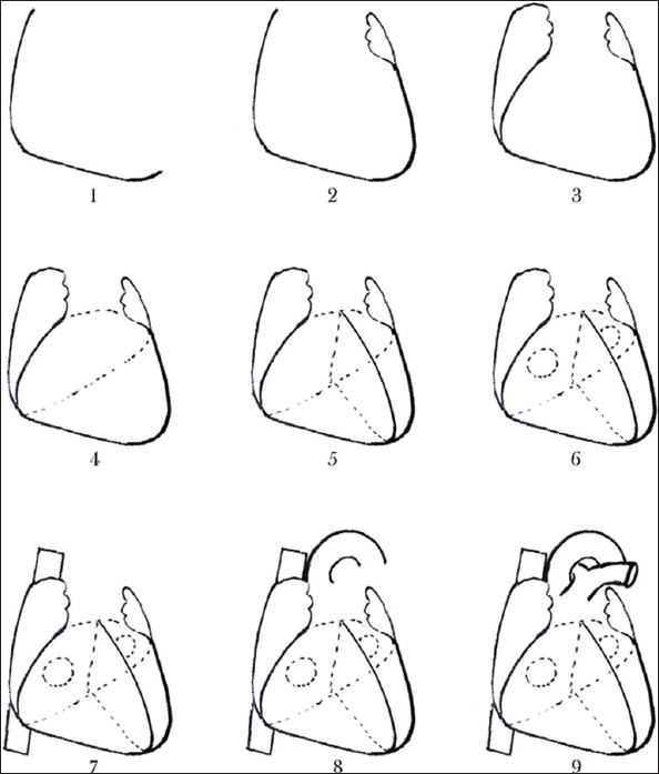 594x697 Simple Human Heart Drawing