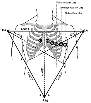 311x350 Ecg Learning Center