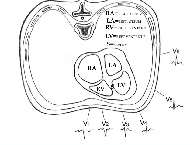 638x479 Ecg 4 Pdf
