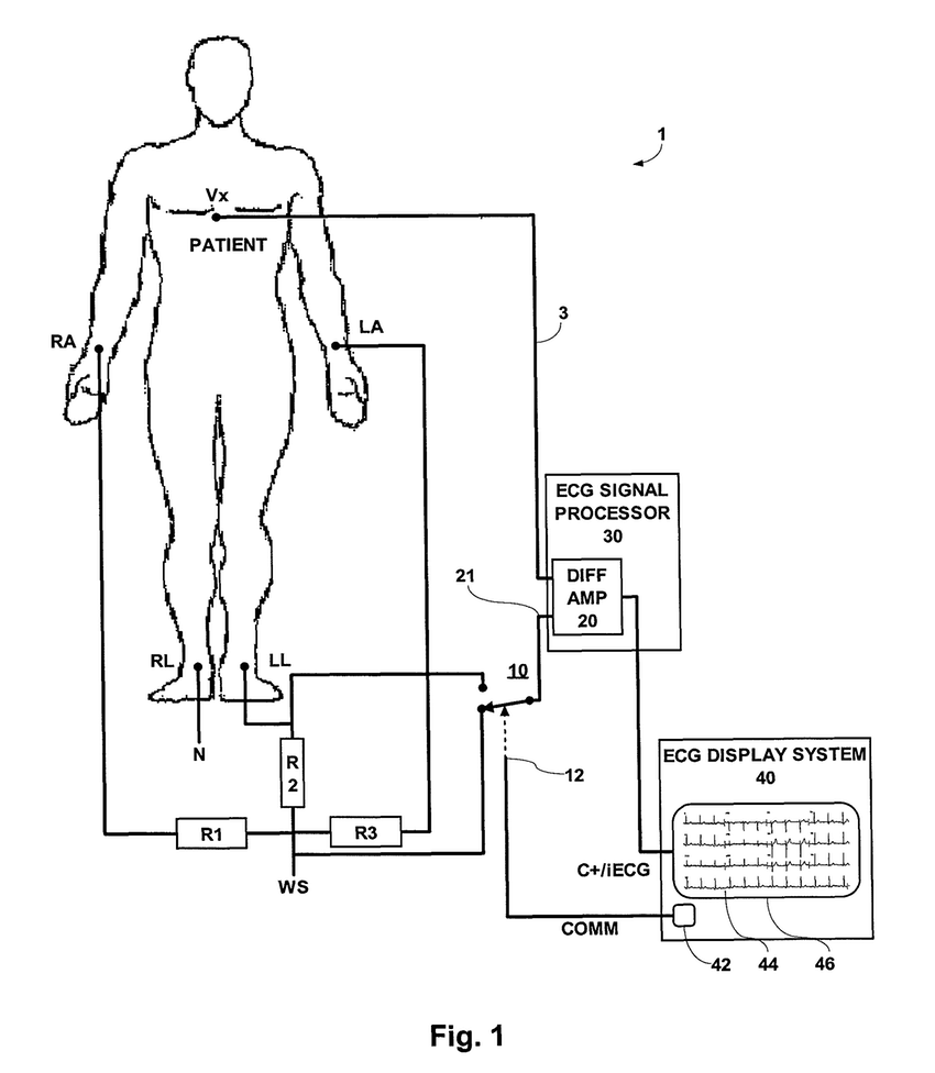 850x976 Einthoven Ecg ~ Wiring Diagram Components
