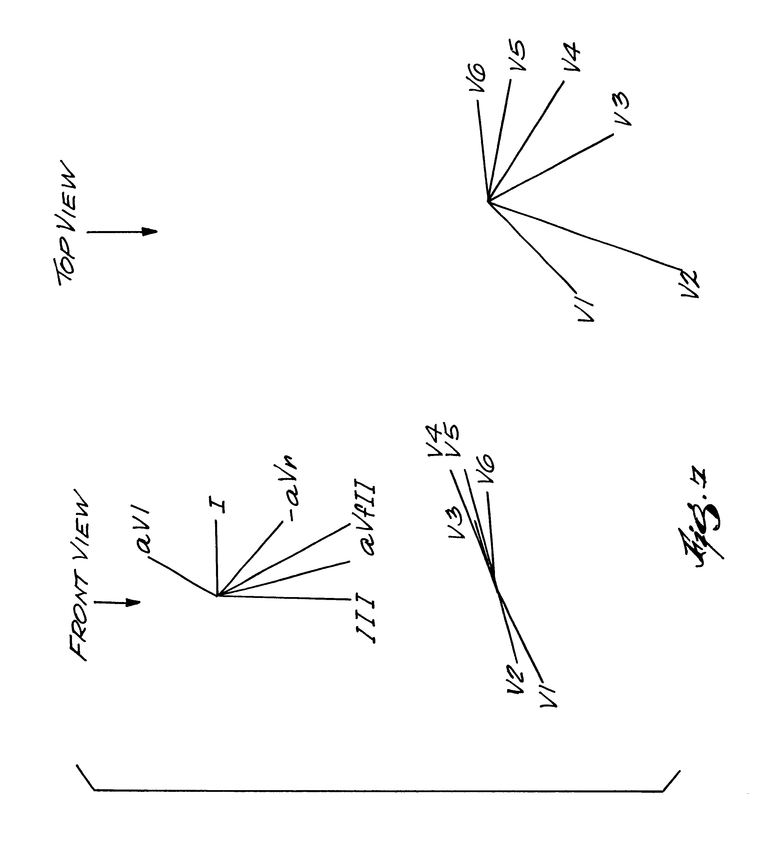 2618x2980 Naming Of The Waves In Ecg With A Brief Account Their Download