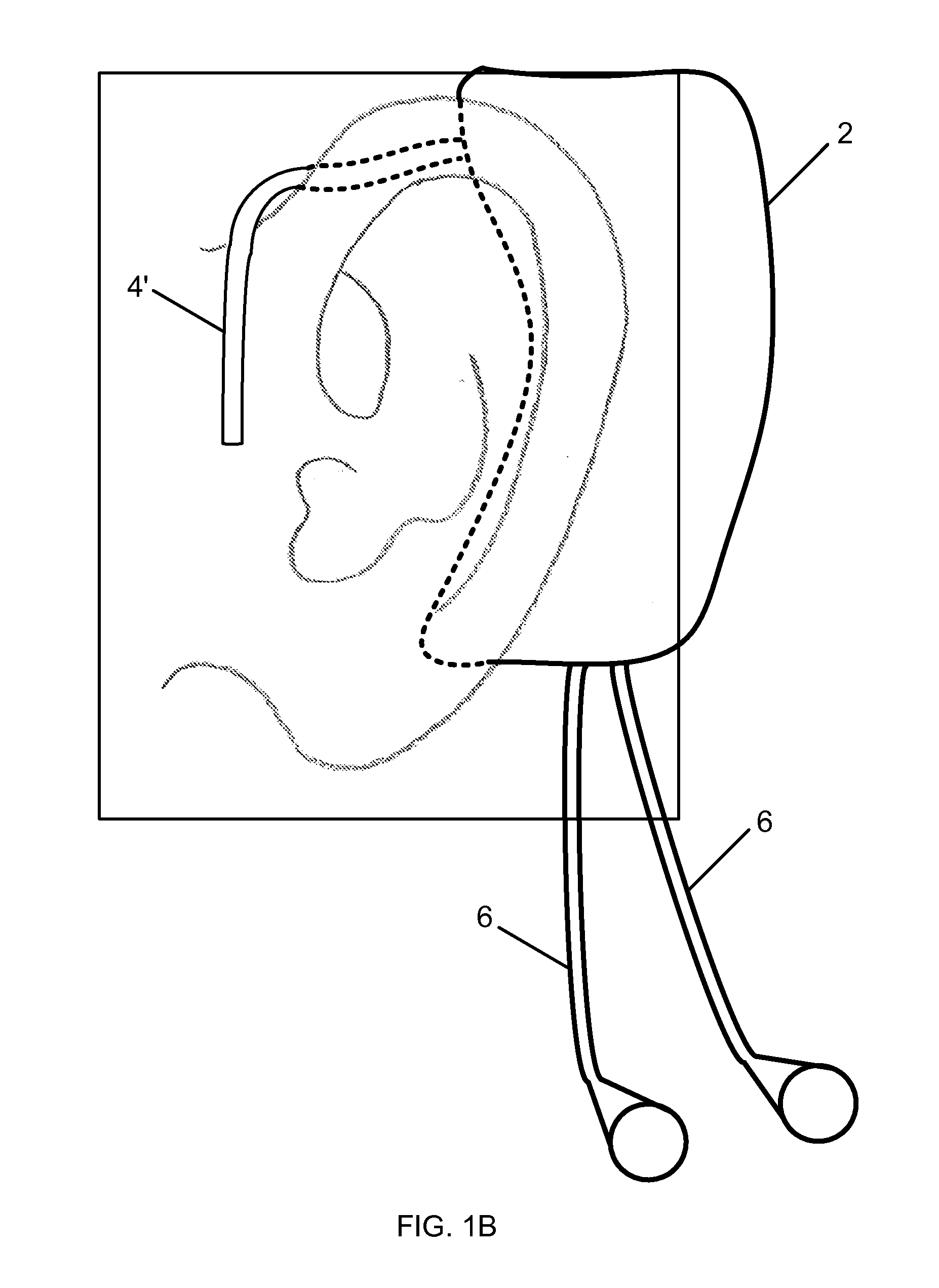 1854x2543 Patent Drawing. Ecg, The Bcg, Or The Ppg Module Earomics