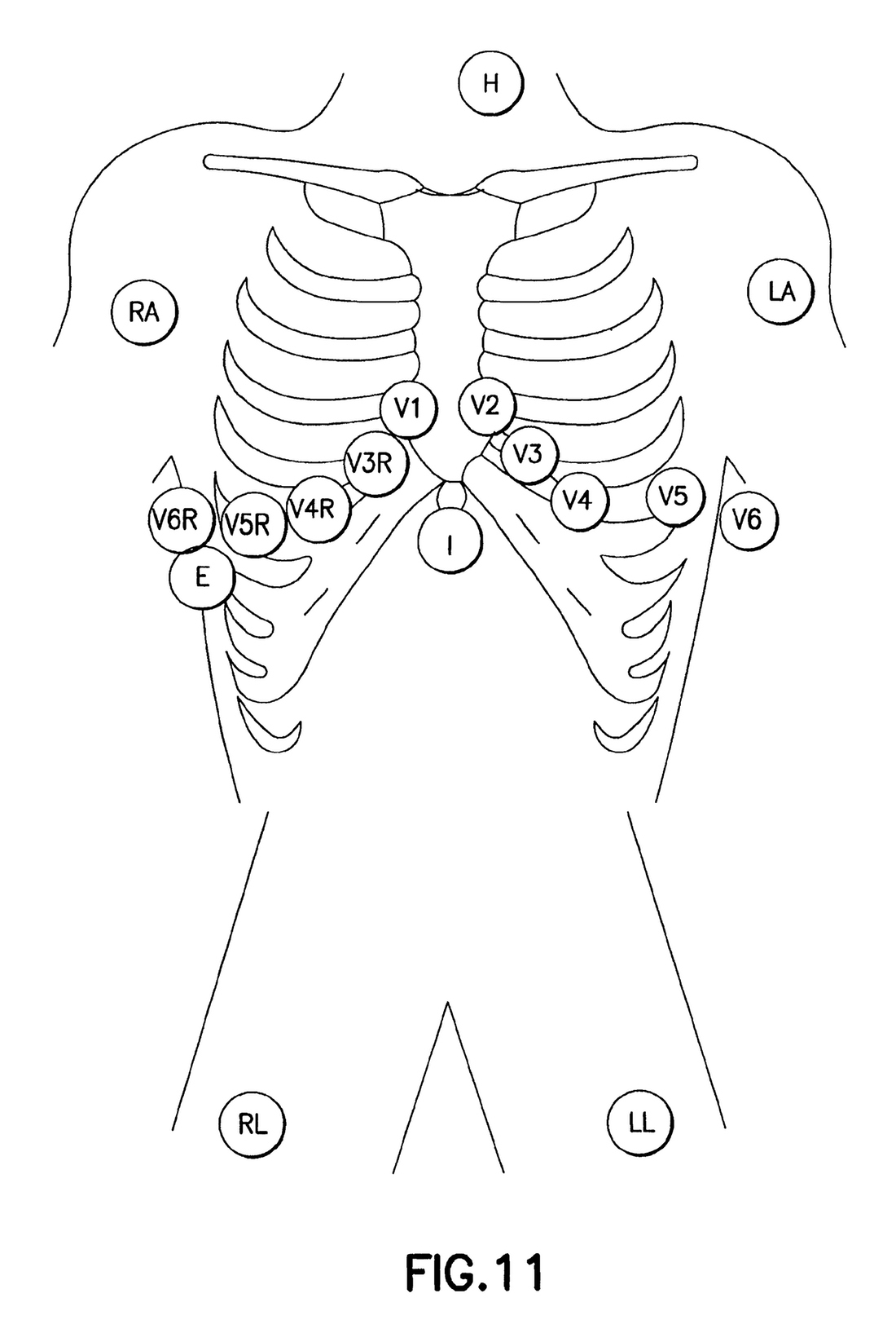 The best free Ecg drawing images. Download from 67 free drawings of Ecg ...