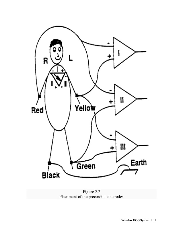 638x826 Wireless Ecg System