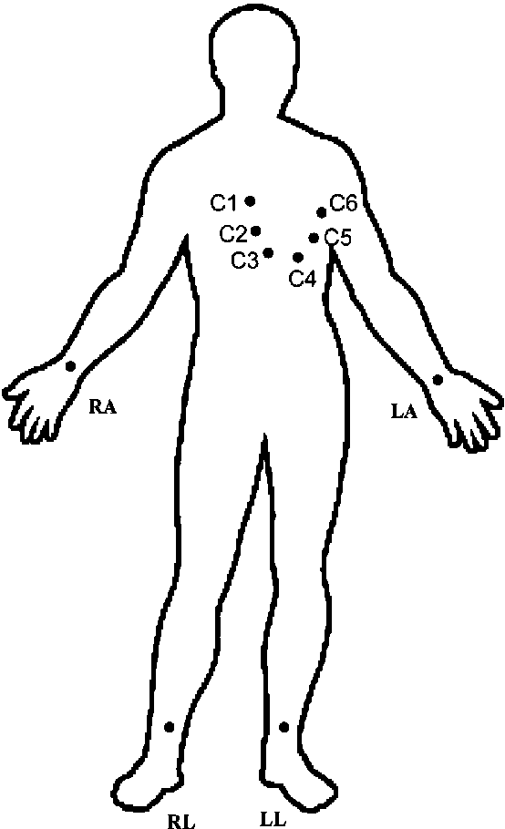 554x910 Points Of Ecg Signals