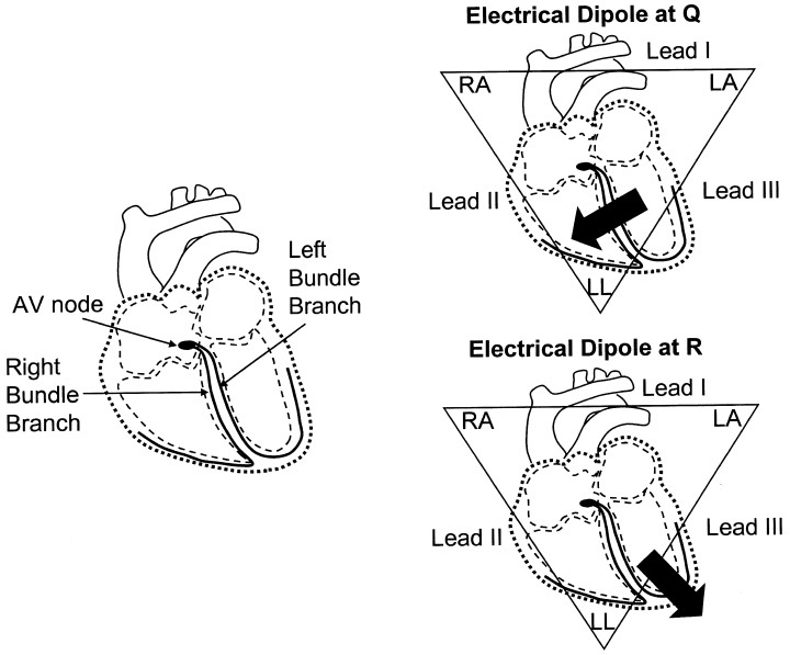 720x597 Cardiac Conduction System And Electrical Dipoles. Left The His