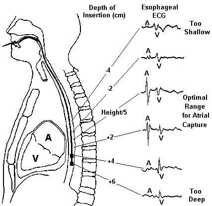 427x415 Cardio Command
