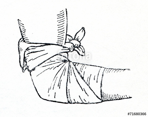 500x395 Triangular Bandage Applied To Elbow Stock Photo And Royalty Free