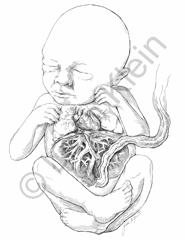 612x792 Medical Illustratoranimator In Training Join Me On My Journey
