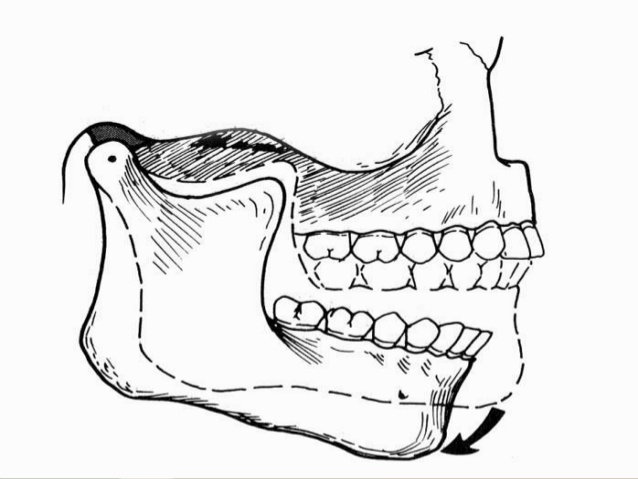 638x479 Posselt's Envelope