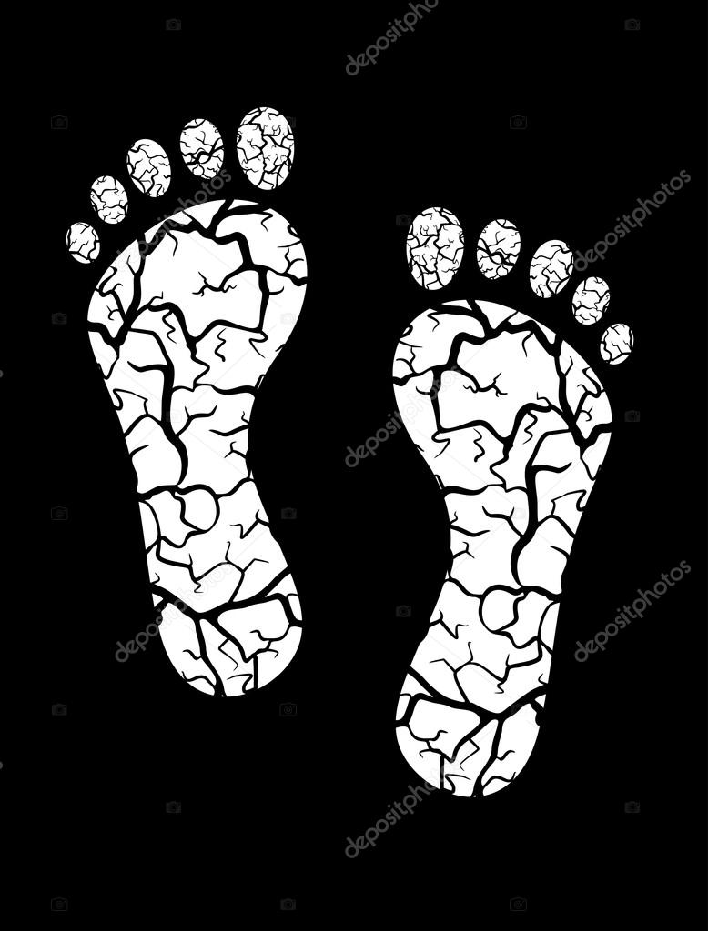 778x1024 Heels With Cracks And Erosion Stock Vector Seamartini