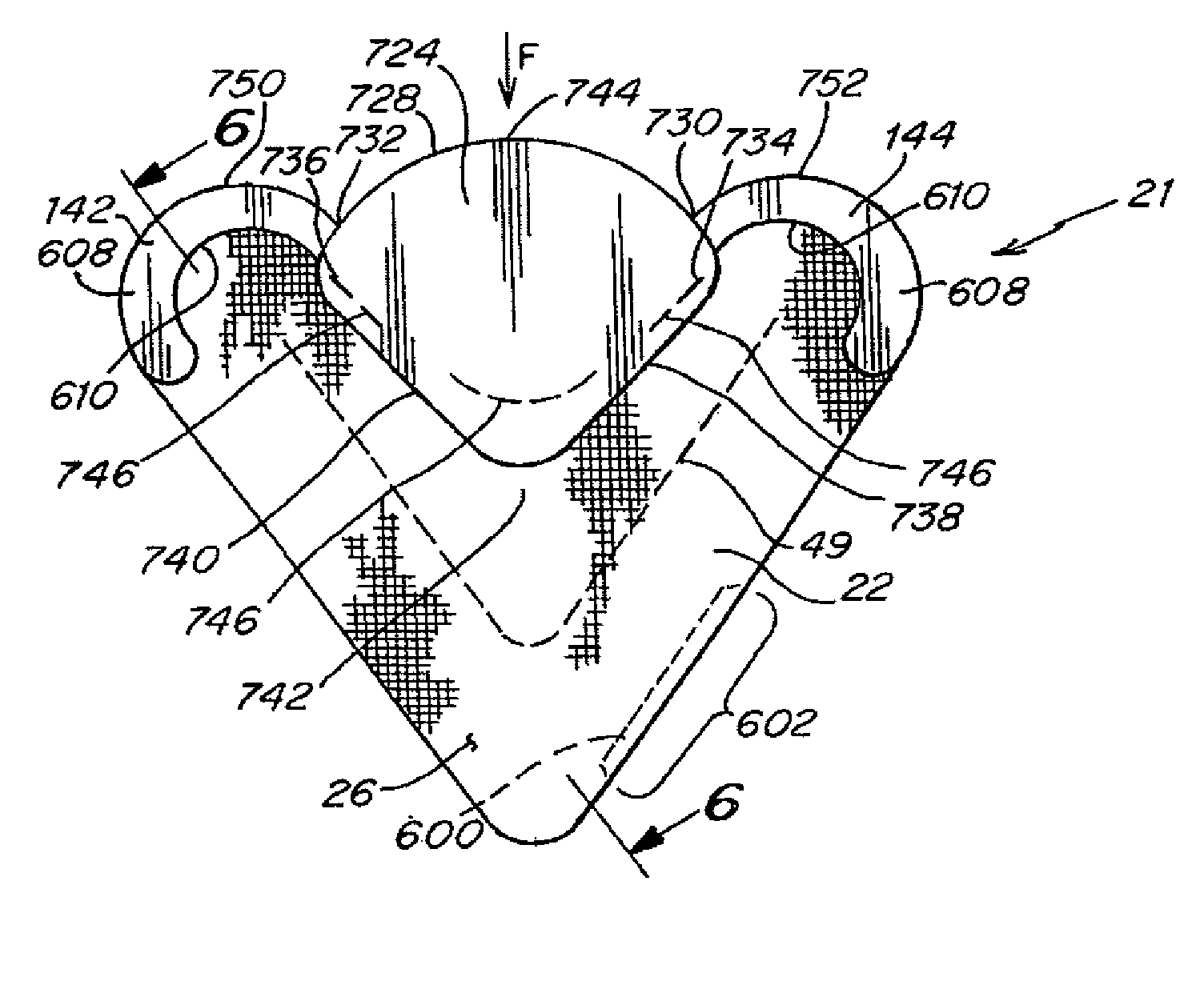 1504x1226 Patent Us20110118851