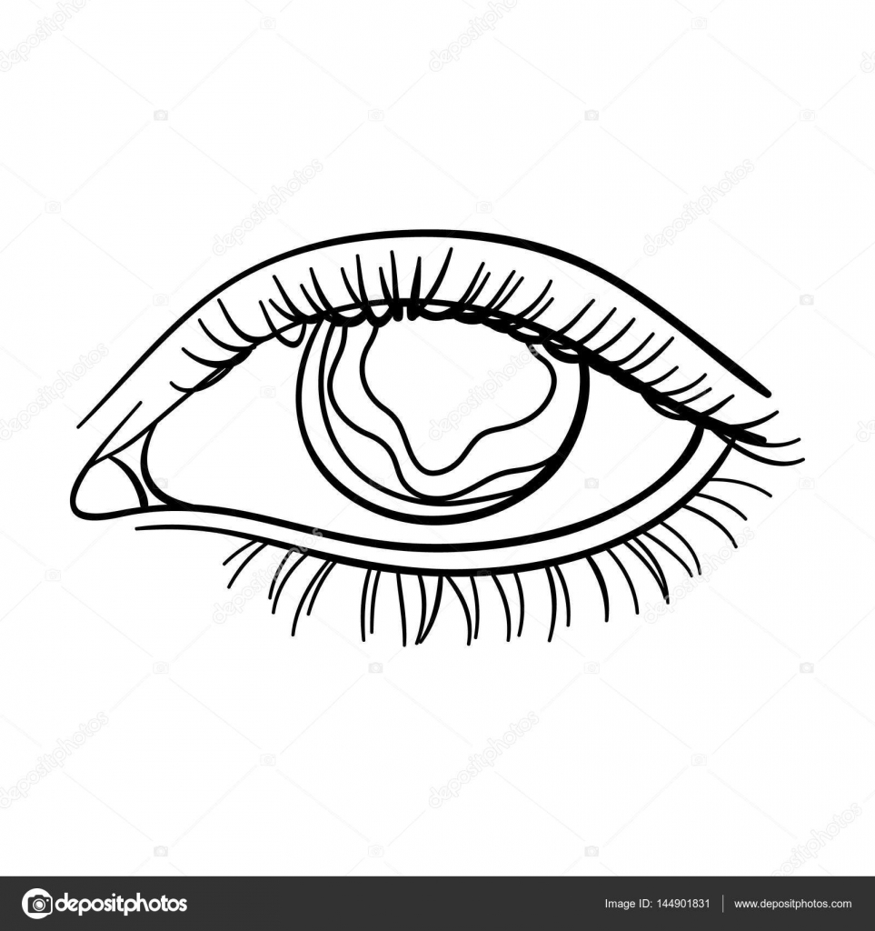 963x1024 Blue Eyes Of A Man Who Suffers Diabetes.brilliant Eyes