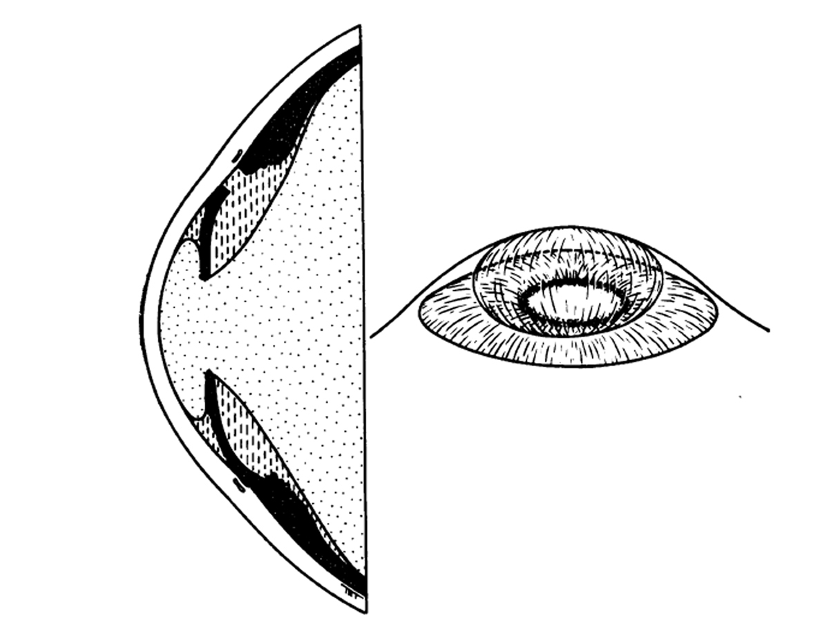 1200x900 Djo Digital Journal Of Ophthalmology
