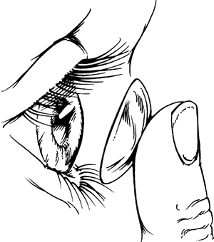 300x340 Contact The Eye Si(Gh)t