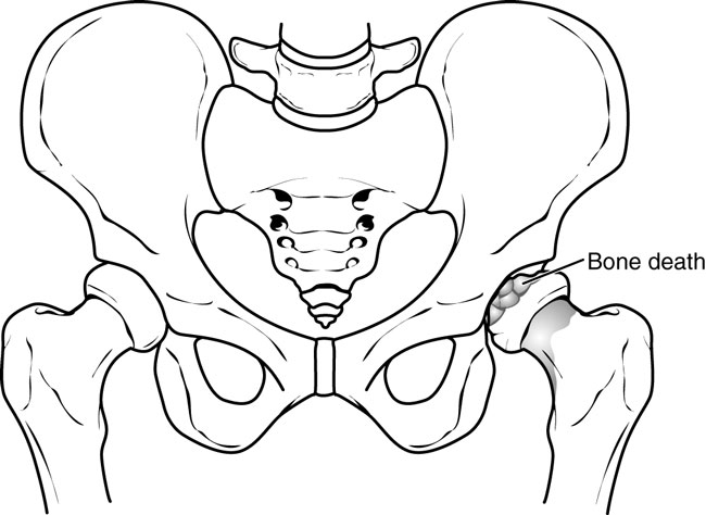 650x474 A00070f02.jpg