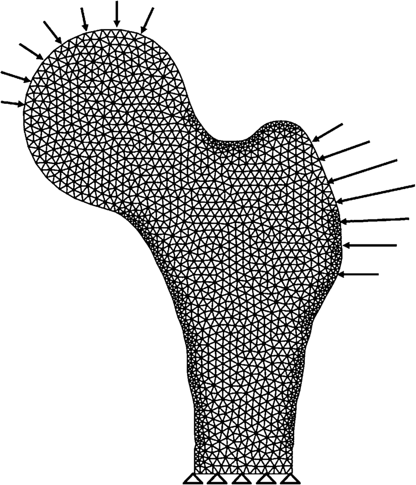 850x990 A) Dxa Based Finite Element Model (B) Critical Locations Of Femur