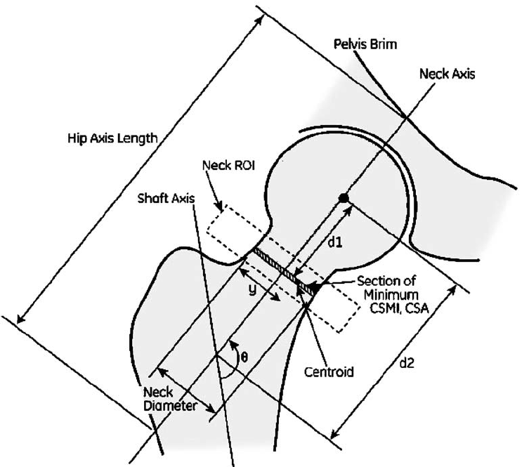 743x665 Variables Used To Measure Fall Index (Fi) And Hip Axis Length (Hal)