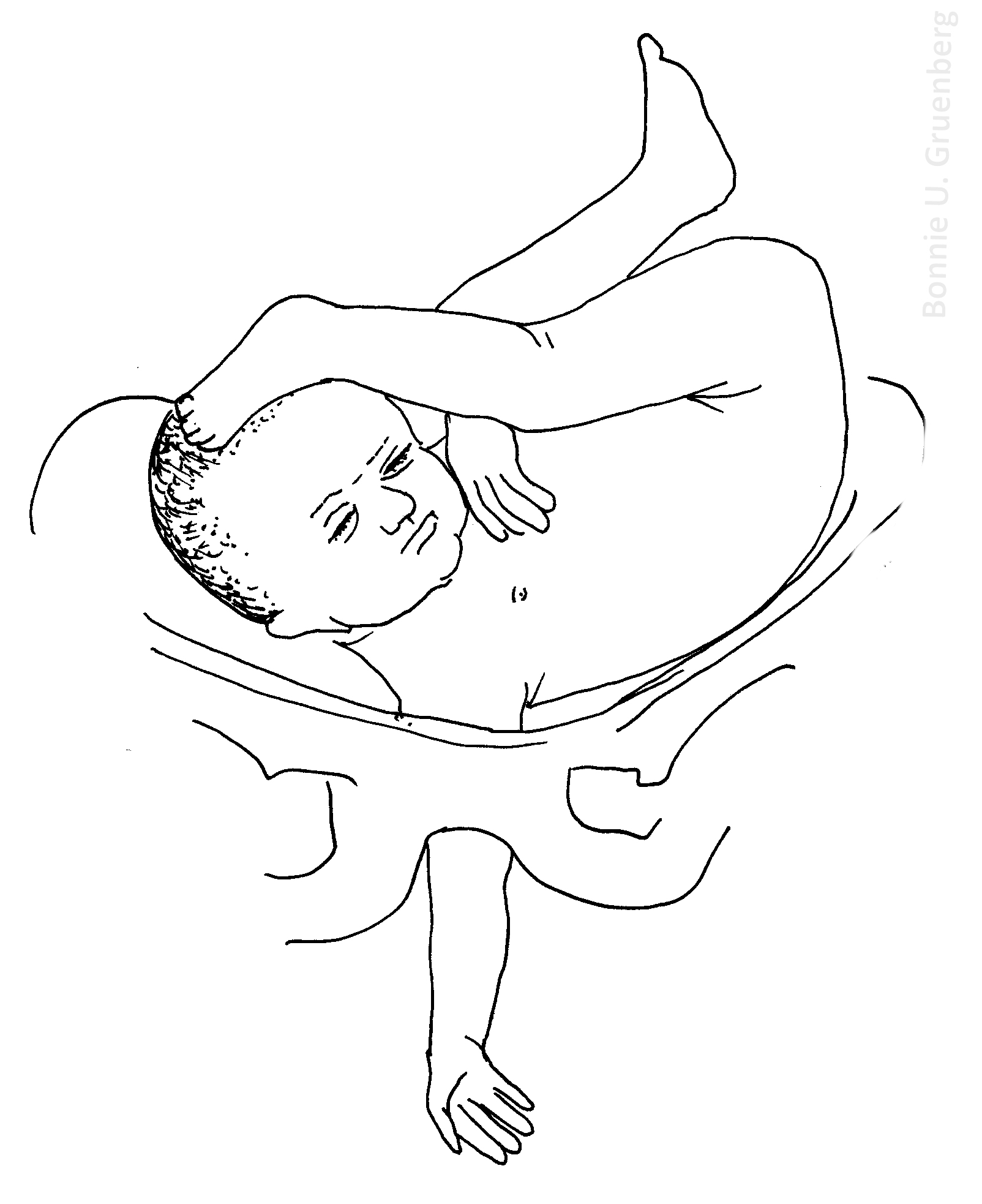 1604x1966 Fileshoulder Arm Presentation Of Fetus.jpg