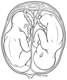 225x270 Image Result For Fetus Line Drawing The Conscious Womb