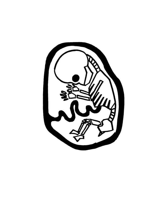 600x825 Dead Fetus By Werdo90