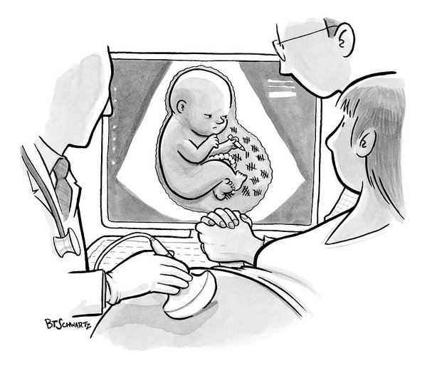 600x517 Fetus Drawings Fine Art America