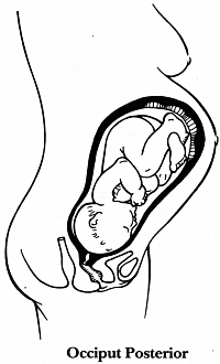 200x330 Pregnancy Childbirth And The Newborn (The Complete Guide) By Penny