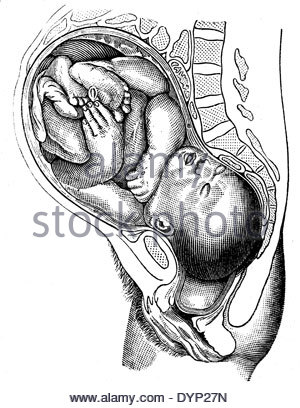 300x408 A Black And White Drawing Of A Pregnant Woman Doing A Stretching