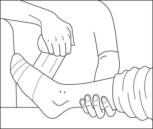 500x422 Pressure Immobilisation Technique