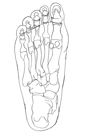 302x456 Common Problems Bc Foot And Ankle []